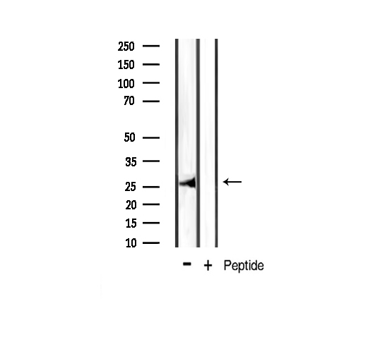 BCL2L1 / BCL-XL Antibody - Western blot analysis of BCL-XL phosphorylation expression in mouse muscle tissue lysates. The lane on the right is treated with the antigen-specific peptide.