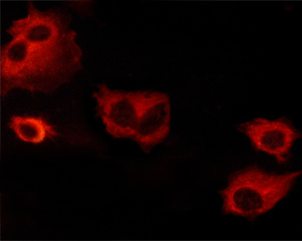 BCL2L1 / BCL-XL Antibody - Staining NIH-3T3 cells by IF/ICC. The samples were fixed with PFA and permeabilized in 0.1% saponin prior to blocking in 10% serum for 45 min at 37°C. The primary antibody was diluted 1/400 and incubated with the sample for 1 hour at 37°C. A Alexa Fluor 594 conjugated goat polyclonal to rabbit IgG (H+L), diluted 1/600 was used as secondary antibody.