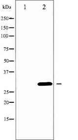 BCL2L1 / BCL-XL Antibody - Western blot analysis of BCL-XL phosphorylation expression in UV treated 293 whole cells lysates. The lane on the left is treated with the antigen-specific peptide.