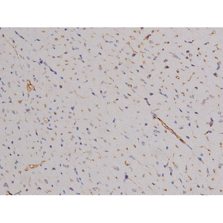 BCL2L1 / BCL-XL Antibody - 1:200 staining rat heart tissue by IHC-P. The tissue was formaldehyde fixed and a heat mediated antigen retrieval step in citrate buffer was performed. The tissue was then blocked and incubated with the antibody for 1.5 hours at 22°C. An HRP conjugated goat anti-rabbit antibody was used as the secondary.