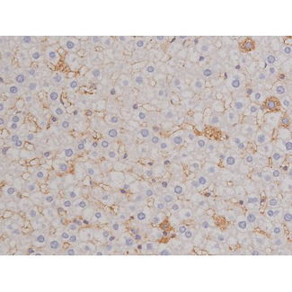 BCL2L1 / BCL-XL Antibody - 1:200 staining rat liver tissue by IHC-P. The tissue was formaldehyde fixed and a heat mediated antigen retrieval step in citrate buffer was performed. The tissue was then blocked and incubated with the antibody for 1.5 hours at 22°C. An HRP conjugated goat anti-rabbit antibody was used as the secondary.