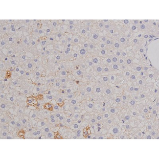 BCL2L1 / BCL-XL Antibody - 1:200 staining rat liver tissue by IHC-P. The tissue was formaldehyde fixed and a heat mediated antigen retrieval step in citrate buffer was performed. The tissue was then blocked and incubated with the antibody for 1.5 hours at 22°C. An HRP conjugated goat anti-rabbit antibody was used as the secondary.