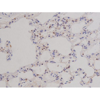 BCL2L1 / BCL-XL Antibody - 1:200 staining rat lung tissue by IHC-P. The tissue was formaldehyde fixed and a heat mediated antigen retrieval step in citrate buffer was performed. The tissue was then blocked and incubated with the antibody for 1.5 hours at 22°C. An HRP conjugated goat anti-rabbit antibody was used as the secondary.