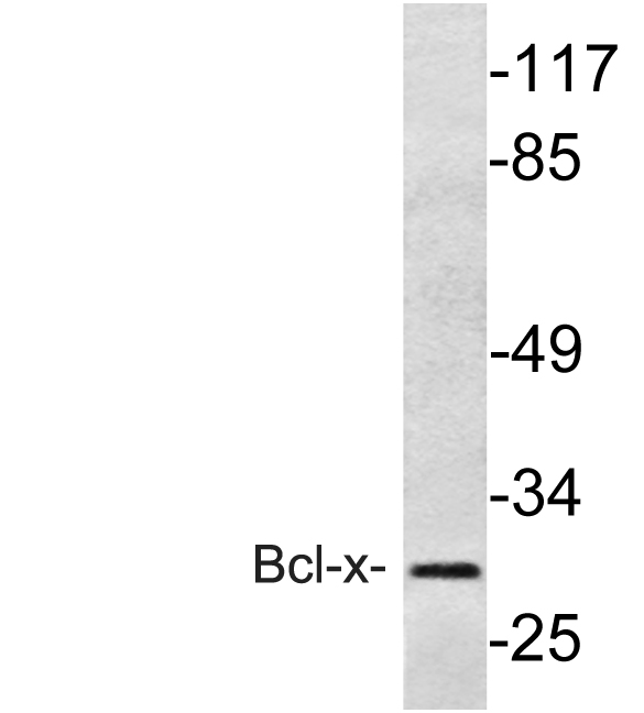 BCL2L1 / BCL-XL Antibody - Western blot of BCL-X(S43) pAb in extracts from 293 cells treated with UV.