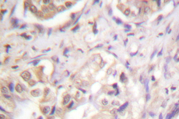 BCL2L1 / BCL-XL Antibody - IHC of BCL-X(S43) pAb in paraffin-embedded human breast tissue.