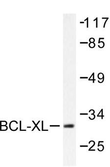 BCL2L1 / BCL-XL Antibody - Western blot of Bcl-XS56) pAb in extracts from 293 cells treated with UV.