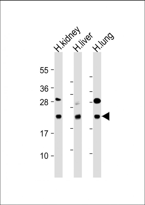 BCL2L10 / Diva Antibody - All lanes: Anti-BCL2L10 Antibody (Center) at 1:2000 dilution Lane 1: Human kidney lysate Lane 2: Human liver lysate Lane 3: Human lung lysate Lysates/proteins at 20 µg per lane. Secondary Goat Anti-Rabbit IgG, (H+L), Peroxidase conjugated at 1/10000 dilution. Predicted band size: 22 kDa Blocking/Dilution buffer: 5% NFDM/TBST.