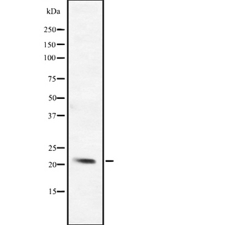 BCL2L10 / Diva Antibody - Western blot analysis of BCL-2L10 expression in HepG2 cells lysate. The lane on the left is treated with the antigen-specific peptide.