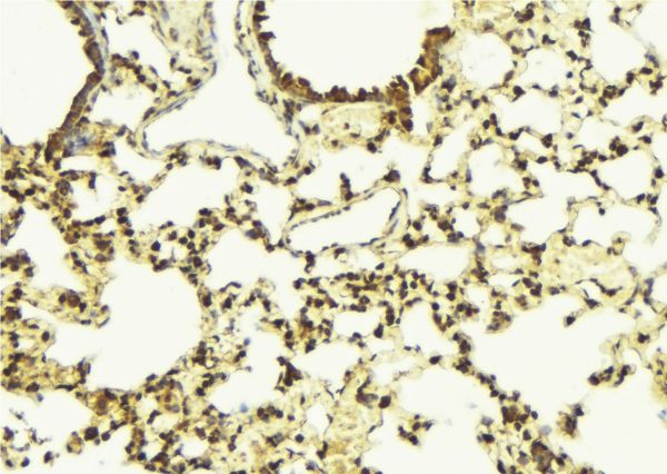 BCL2L10 / Diva Antibody - 1:100 staining mouse lung tissue by IHC-P. The sample was formaldehyde fixed and a heat mediated antigen retrieval step in citrate buffer was performed. The sample was then blocked and incubated with the antibody for 1.5 hours at 22°C. An HRP conjugated goat anti-rabbit antibody was used as the secondary.