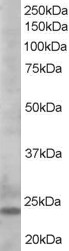 BCL2L11 / BIM Antibody - Antibody staining (0.5 ug/ml) of K562lysate (RIPA buffer, 35 ug total protein per lane). Primary incubated for 1 hour. Detected by Western blot of chemiluminescence.