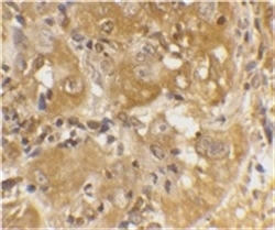 BCL2L11 / BIM Antibody - IHC of human skin with Rabbit anti-BIM (RABBIT ANTI BIM).