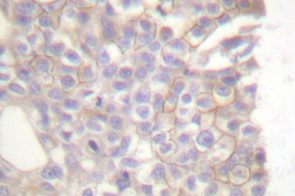 BCL2L11 / BIM Antibody - IHC of BIM-/ (A2) pAb in paraffin-embedded human COS7 tissue.