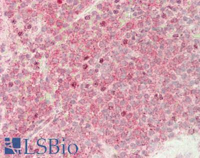 BCL2L11 / BIM Antibody - Human Spleen: Formalin-Fixed, Paraffin-Embedded (FFPE)
