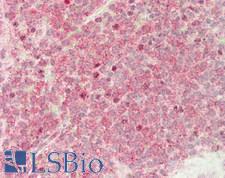 BCL2L11 / BIM Antibody - Human Spleen: Formalin-Fixed, Paraffin-Embedded (FFPE)