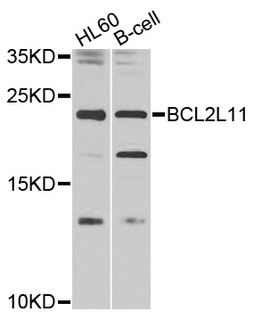 BCL2L11 / BIM Antibody - Western blot analysis of extracts of various cell lines, using BCL2L11 antibody at 1:1000 dilution. The secondary antibody used was an HRP Goat Anti-Rabbit IgG (H+L) at 1:10000 dilution. Lysates were loaded 25ug per lane and 3% nonfat dry milk in TBST was used for blocking. An ECL Kit was used for detection and the exposure time was 60s.