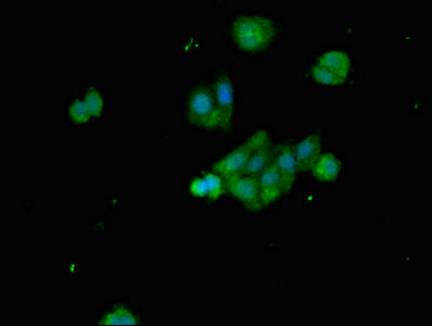 BCL2L11 / BIM Antibody - Immunofluorescent analysis of HepG2 cells at a dilution of 1:100 and Alexa Fluor 488-congugated AffiniPure Goat Anti-Rabbit IgG(H+L)