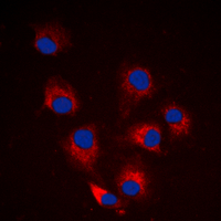 BCL2L11 / BIM Antibody - Immunofluorescent analysis of BIM (pS69) staining in HeLa cells. Formalin-fixed cells were permeabilized with 0.1% Triton X-100 in TBS for 5-10 minutes and blocked with 3% BSA-PBS for 30 minutes at room temperature. Cells were probed with the primary antibody in 3% BSA-PBS and incubated overnight at 4 C in a humidified chamber. Cells were washed with PBST and incubated with a DyLight 594-conjugated secondary antibody (red) in PBS at room temperature in the dark. DAPI was used to stain the cell nuclei (blue).