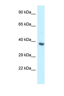 BCL2L12 Antibody - BCL2L12 antibody Western blot of Fetal Heart lysate. Antibody concentration 1 ug/ml.  This image was taken for the unconjugated form of this product. Other forms have not been tested.