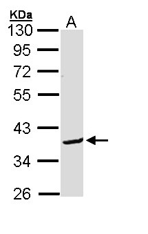 BCL2L12 Antibody - Sample (30 ug of whole cell lysate). A: Molt-4 . 10% SDS PAGE. BCL2L12 antibody diluted at 1:1000.