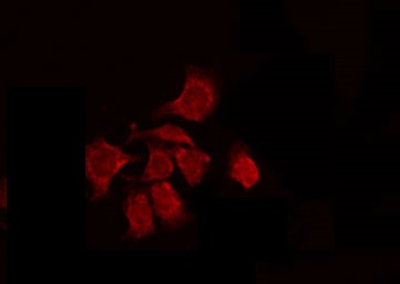 BCL2L12 Antibody - Staining HepG2 cells by IF/ICC. The samples were fixed with PFA and permeabilized in 0.1% Triton X-100, then blocked in 10% serum for 45 min at 25°C. The primary antibody was diluted at 1:200 and incubated with the sample for 1 hour at 37°C. An Alexa Fluor 594 conjugated goat anti-rabbit IgG (H+L) Ab, diluted at 1/600, was used as the secondary antibody.