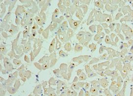BCL2L13 / Bcl Rambo Antibody - Immunohistochemistry of paraffin-embedded human heart using antibody at 1:100 dilution.