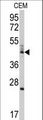 BCL2L13 / Bcl Rambo Antibody - Western blot of anti-BCL2L13 Antibody in CEM cell line lysates (35 ug/lane). BCL2L13(arrow) was detected using the purified antibody.