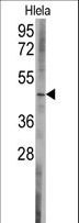 BCL2L13 / Bcl Rambo Antibody - Western blot of anti-BCL2L13 Antibody in HeLa cell line lysates (35 ug/lane). BCL2L13(arrow) was detected using the purified antibody.