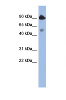 BCL2L13 / Bcl Rambo Antibody - BCL2L13 / Bcl Rambo antibody Western blot of H226 Cell lysate. Antibody concentration 1 ug/ml. This image was taken for the unconjugated form of this product. Other forms have not been tested.