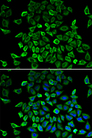 BCL2L13 / Bcl Rambo Antibody - Immunofluorescence analysis of HeLa cells.