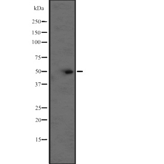 BCL2L13 / Bcl Rambo Antibody - Western blot analysis of BCL-2L13 expression in CEM cells line lysate. The lane on the left is treated with the antigen-specific peptide.