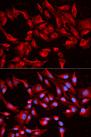 BCL2L13 / Bcl Rambo Antibody - Immunofluorescence analysis of HeLa cells using BCL2L13 Polyclonal Antibody.