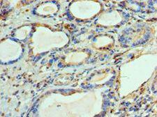 BCL2L14 / BCL-G Antibody - Immunohistochemistry of paraffin-embedded human prostate using antibody at 1:100 dilution.