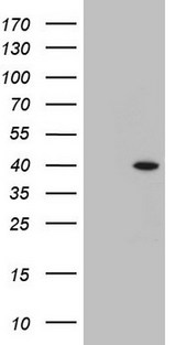 BCL2L14 / BCL-G Antibody - HEK293T cells were transfected with the pCMV6-ENTRY control. (Left lane) or pCMV6-ENTRY BCL2L14. (Right lane) cDNA for 48 hrs and lysed. Equivalent amounts of cell lysates. (5 ug per lane) were separated by SDS-PAGE and immunoblotted with anti-BCL2L14. (1:2000)