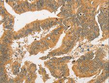 BCL2L14 / BCL-G Antibody - Immunohistochemistry of paraffin-embedded Human tonsil using BCL2L14 Polyclonal Antibody at dilution of 1:40.