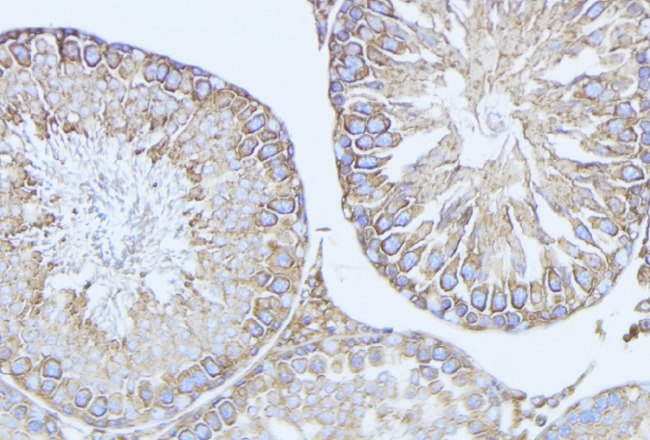 BCL2L14 / BCL-G Antibody - 1:100 staining mouse testis tissue by IHC-P. The sample was formaldehyde fixed and a heat mediated antigen retrieval step in citrate buffer was performed. The sample was then blocked and incubated with the antibody for 1.5 hours at 22°C. An HRP conjugated goat anti-rabbit antibody was used as the secondary.