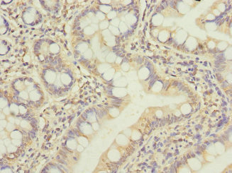 BCL2L15 Antibody - Immunohistochemistry of paraffin-embedded human small intestine at dilution 1:100