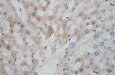 BCL2L15 Antibody - Immunohistochemistry of paraffin-embedded Rat liver using BCL2L15 Polyclonal Antibody at dilution of 1:50.