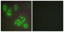 BCL2L2 / Bcl-w Antibody - Immunofluorescence analysis of HepG2 cells, using BCLW Antibody. The picture on the right is blocked with the synthesized peptide.