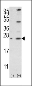 BCL2L2 / Bcl-w Antibody - Western blot of Bcl-w3 (arrow) using rabbit polyclonal Bcl-w BH3 Domain Antibody. 293 cell lysates (2 ug/lane) either nontransfected (Lane 1) or transiently transfected with the BCL2L2 gene (Lane 2) (Origene Technologies).