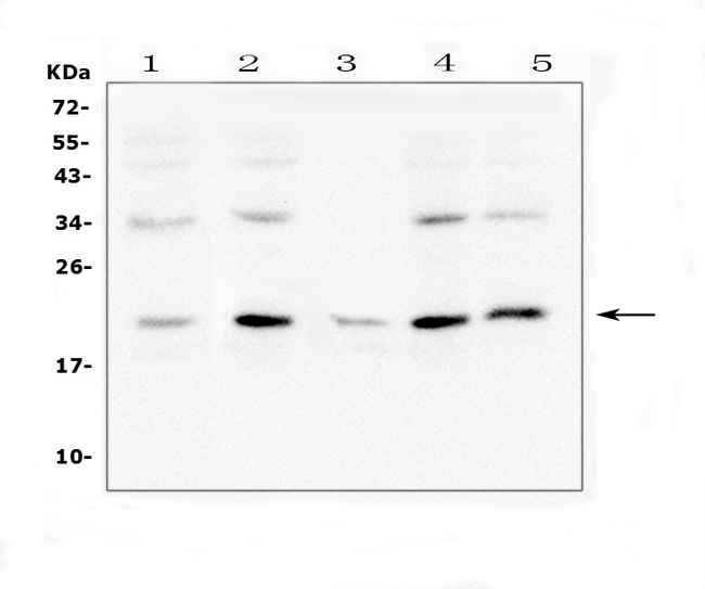 BCL2L2 / Bcl-w Antibody - Western blot analysis of Bcl2L2 using anti-Bcl2L2 antibody. Electrophoresis was performed on a 5-20% SDS-PAGE gel at 70V (Stacking gel) / 90V (Resolving gel) for 2-3 hours. The sample well of each lane was loaded with 50ug of sample under reducing conditions. Lane 1: human A549 whole cell lysates, Lane 2: human K562 whole cell lysates, Lane 3: human U-937 whole cell lysates, Lane 4: human Hela whole cell lysates. , Lane 5: human A431 whole cell lysates. After Electrophoresis, proteins were transferred to a Nitrocellulose membrane at 150mA for 50-90 minutes. Blocked the membrane with 5% Non-fat Milk/ TBS for 1.5 hour at RT. The membrane was incubated with rabbit anti-Bcl2L2 antigen affinity purified polyclonal antibody at 0.5 µg/mL overnight at 4°C, then washed with TBS-0.1% Tween 3 times with 5 minutes each and probed with a goat anti-rabbit IgG-HRP secondary antibody at a dilution of 1:10000 for 1.5 hour at RT. The signal is developed using an Enhanced Chemiluminescent detection (ECL) kit with Tanon 5200 system. A specific band was detected for Bcl2L2 at approximately 21KD. The expected band size for Bcl2L2 is at 21KD.