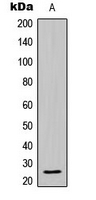 BCL2L2 / Bcl-w Antibody - Western blot analysis of BCLW expression in HL60 (A) whole cell lysates.