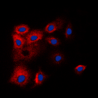 BCL2L2 / Bcl-w Antibody - Immunofluorescent analysis of BCLW staining in HL60 cells. Formalin-fixed cells were permeabilized with 0.1% Triton X-100 in TBS for 5-10 minutes and blocked with 3% BSA-PBS for 30 minutes at room temperature. Cells were probed with the primary antibody in 3% BSA-PBS and incubated overnight at 4 C in a humidified chamber. Cells were washed with PBST and incubated with a DyLight 594-conjugated secondary antibody (red) in PBS at room temperature in the dark. DAPI was used to stain the cell nuclei (blue).