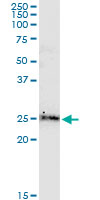 BCL2L2 / Bcl-w Antibody - BCL2L2 monoclonal antibody (M01), clone 2E4. Western Blot analysis of BCL2L2 expression in human colon.