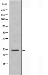 BCL2L2 / Bcl-w Antibody - Western blot analysis of extracts of COLO cells using BCLW antibody.