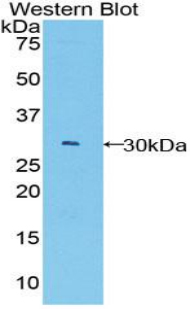 BCL3 / BCL-3 Antibody - Western blot of recombinant BCL3 / BCL-3.  This image was taken for the unconjugated form of this product. Other forms have not been tested.