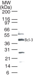 BCL3 / BCL-3 Antibody - Western blot of Bcl-3 in Jurkat cells using antibody at 0.5 ug/ml.