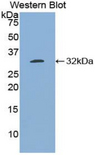 BCL3 / BCL-3 Antibody - Western blot of recombinant BCL3 / BCL-3.