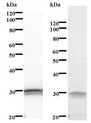 BCL3 / BCL-3 Antibody - Western blot of immunized recombinant protein using BCL3 antibody. Left: BCL3 staining. Right: Coomassie Blue staining of immunized recombinant protein.