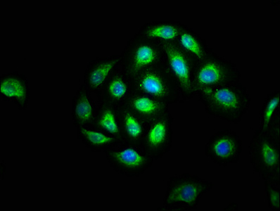 BCL3 / BCL-3 Antibody - Immunofluorescence staining of A549 cells with BCL3 Antibody at 1:133, counter-stained with DAPI. The cells were fixed in 4% formaldehyde, permeabilized using 0.2% Triton X-100 and blocked in 10% normal Goat Serum. The cells were then incubated with the antibody overnight at 4°C. The secondary antibody was Alexa Fluor 488-congugated AffiniPure Goat Anti-Rabbit IgG(H+L).