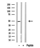 BCL3 / BCL-3 Antibody - Western blot analysis of BCL-3 in lysates of HeLa cells using BCL-3 antibody.